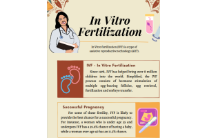 In Vitro Fertilization